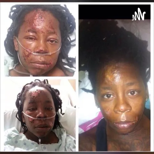 HIMLADY VS CEE