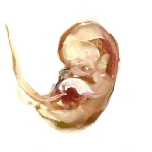 Abortion