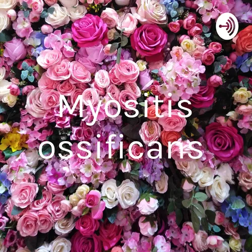 Myositis ossificans