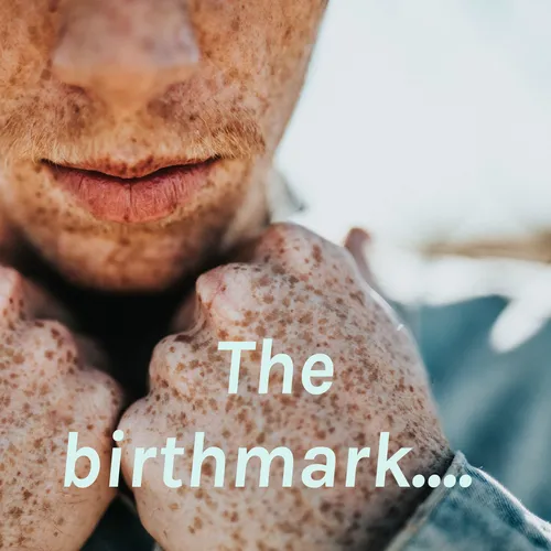 The birthmark....