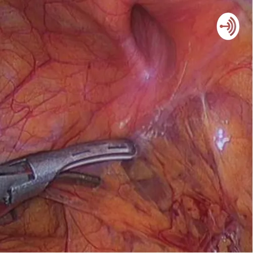 UCS Undestanding Clinical Surgery - Pancreatitis