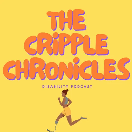 3 years, one leg. how has life moved on? | cripple chronicles podcast (Ep.51)